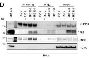 Nup153 forms complexes with eNOS, ERβ and p300(A) Confocal analysis of Prostate Cancer (PCa, C27IM) and Benign Prostatic Hyperplasia (BPH, C17IM) cells stained with antibodies to Nup153 ([QE5], red) or eNOS (Type III, green). (HSP90 antibody)