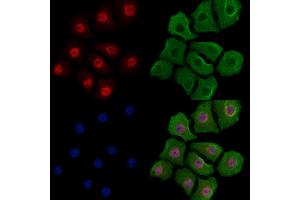 Phospho-YY1 (Ser365) Antibody staining Hela cells(heat shock treatment) by IF/ICC.