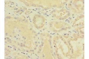 Immunohistochemistry of paraffin-embedded human kidney tissue using ABIN7151868 at dilution of 1:100 (EPH Receptor B4 antibody  (AA 300-540))