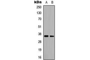 Western blot analysis of CD34 expression in HeLa (A), HepG2 (B) whole cell lysates. (CD34 antibody  (Center))