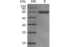 Western Blotting (WB) image for Leukocyte-Associated Immunoglobulin-Like Receptor 1 (LAIR1) protein (mFc Tag) (ABIN7319831) (LAIR1 Protein (mFc Tag))