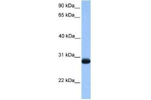 ZMAT3 antibody used at 0. (ZMAT3 antibody  (N-Term))