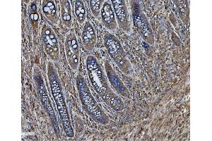 IHC analysis of PDIA6 using anti-PDIA6 antibody (ABIN7600553). (PDIA6 antibody  (AA 20-440))