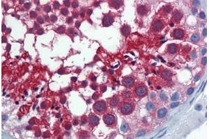 Human Testis: Formalin-Fixed, Paraffin-Embedded (FFPE) (Importin 5 antibody  (AA 1-101))