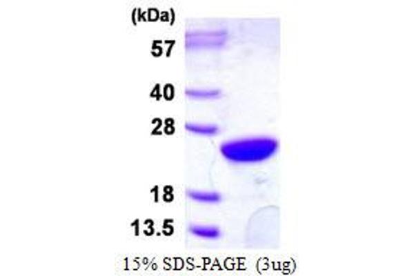 UBE2M Protein (His tag)