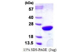 Image no. 1 for Ubiquitin-Conjugating Enzyme E2M (ube2m) protein (His tag) (ABIN1098637) (UBE2M Protein (His tag))