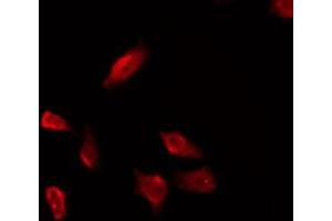 ABIN6275982 staining COLO205 by IF/ICC. (EDG4 antibody)