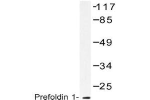 Western blot (WB) analysis of Prefoldin 1 antibody in extracts from RAW264. (PFDN1 antibody)