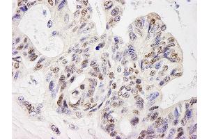 Immunohistochemistry (IHC) image for anti-E74-Like Factor 1 (Ets Domain Transcription Factor) (ELF1) (AA 569-619) antibody (ABIN7453835)