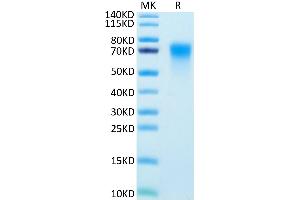 TNFRSF21 Protein (AA 42-349) (His tag)