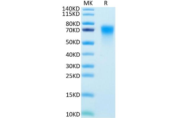 TNFRSF21 Protein (AA 42-349) (His tag)