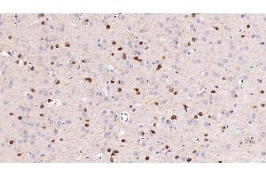 Detection of NGAL in Rat Cerebrum Tissue using Monoclonal Antibody to Neutrophil gelatinase-associated lipocalin (NGAL) (Lipocalin 2 antibody  (AA 21-198))