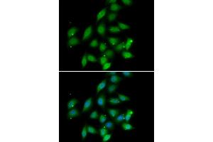 Immunofluorescence analysis of HeLa cell using PPP2CA antibody. (PPP2CA antibody)