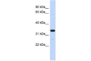 FAM76A antibody used at 1 ug/ml to detect target protein. (FAM76A antibody  (N-Term))