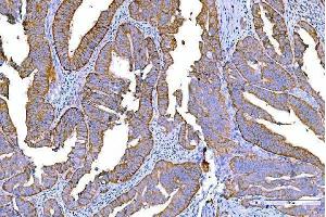 IHC analysis of RALBP1 using anti-RALBP1 antibody (ABIN7600800).
