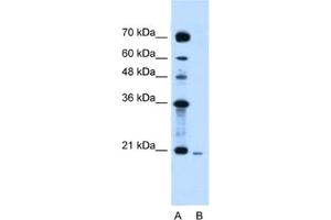Western Blotting (WB) image for anti-Synovial Sarcoma, X Breakpoint 2 (SSX2) antibody (ABIN2461583)