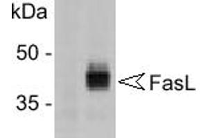 Detection of FasL in 293T cells transfected with a FasL expression plasmid (right panel). (FASL antibody  (AA 196-220))