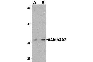 Western blot analysis of Aldh3A2 in mouse liver lysate with AP30044PU-N Aldh3A2 antibody at (A) 1 and (B) 2 μg/ml. (ALDH3A2 antibody  (C-Term))