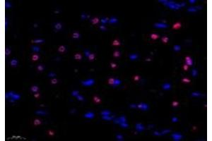 Immunofluorescent analysis of paraformaldehyde-fixed rat hippocampus using ZNF154 (ABIN7076261) at dilution of 1: 1000 (ZNF154 antibody)