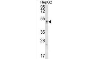 Western Blotting (WB) image for anti-WD Repeat Domain 12 (WDR12) antibody (ABIN5016731) (WDR12 antibody)