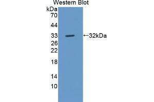 Figure. (ROS1 antibody  (AA 1937-2210))