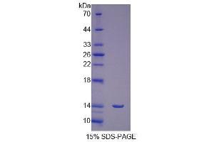 SDS-PAGE (SDS) image for Follicle Stimulating Hormone Receptor (FSHR) (AA 18-113) protein (His tag) (ABIN1079596) (FSHR Protein (AA 18-113) (His tag))