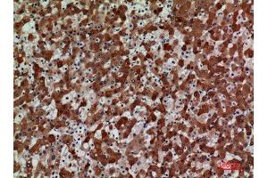 Immunohistochemistry (IHC) analysis of paraffin-embedded Human Liver, antibody was diluted at 1:100. (CCR3 antibody  (N-Term))