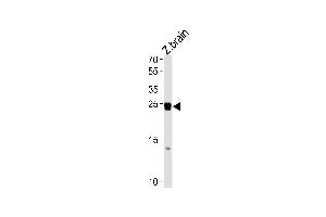 DANRE neurog1 Antibody (Center) Azb10027b western blot analysis in zebra fish brain tissue lysates (35 μg/lane). (Neurogenin 1 antibody  (AA 112-138))