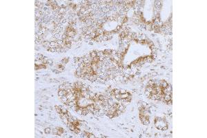 Immunohistochemistry (IHC) image for anti-Dihydrolipoamide Dehydrogenase (DLD) (AA 459-509) antibody (ABIN7453411)