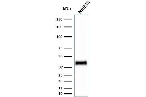 BMI1 抗体  (AA 142-326)