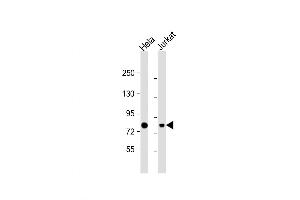 Western Blot at 1:1000 dilution Lane 1: Hela whole cell lysate Lane 2: Jurkat whole cell lysate Lysates/proteins at 20 ug per lane. (HADHA antibody  (C-Term))