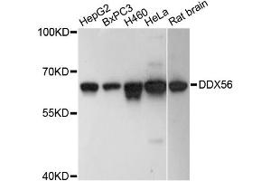 Western blot analysis of extracts of various cell lines, using DDX56 antibody. (DDX56 antibody)