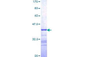 Image no. 1 for V-Raf Murine Sarcoma 3611 Viral Oncogene Homolog (ARAF) (AA 151-250) protein (GST tag) (ABIN1345436) (ARAF Protein (AA 151-250) (GST tag))