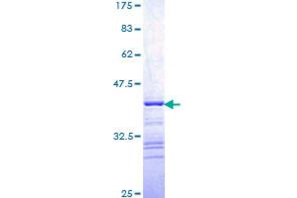 ARAF Protein (AA 151-250) (GST tag)
