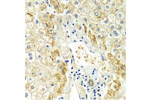 Immunohistochemistry of paraffin-embedded Human liver injury using ERG antibody at dilution of 1:100 (x400 lens).
