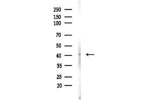 anti-Melanoma Antigen Family A, 10 (MAGEA10) (Internal Region) antibody