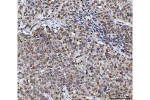 IHC analysis of UBA6 using anti-UBA6 antibody (ABIN7602559). (UBA6 antibody  (AA 85-1033))