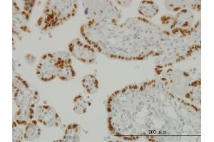 Immunoperoxidase of monoclonal antibody to TFAP2A on formalin-fixed paraffin-embedded human placenta. (TFAP2A antibody  (AA 99-205))
