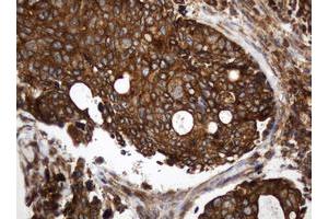 Image no. 1 for anti-TAP Binding Protein-Like (TAPBPL) antibody (ABIN1501302) (TAPBPL antibody)