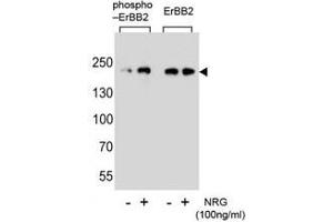 Western blot analysis of extracts from SK-BR-3 cell, untreated or treated with NRG, using phospho-ErbB2 (left) or nonphos Ab (right). (ErbB2/Her2 antibody  (pTyr1140))
