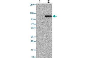 Western blot analysis of Lane 1: Negative control (vector only transfected HEK293T lysate) Lane 2: Over-expression Lysate (Co-expressed with a C-terminal myc-DDK tag (~3. (TUBGCP3 antibody)
