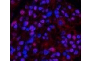 Immunofluorescence analysis of Rat kidney tissue using beta Tubulin Polyclonal Antibody at dilution of 1:200. (TUBB antibody)