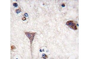 IHC analysis of FFPE human brain tissue stained with B-RAF antibody (BRAF antibody  (AA 379-408))