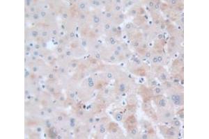 Used in DAB staining on fromalin fixed paraffin- embedded Kidney tissue (VAV1 antibody  (AA 426-696))