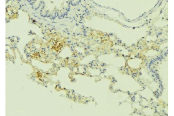 RRAD antibody  (Internal Region)