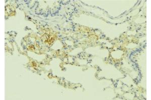 ABIN6275172 at 1/100 staining Human lung tissue by IHC-P. (RRAD antibody  (Internal Region))