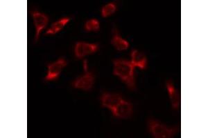 ABIN6274366 staining Hela by IF/ICC. (SURF1 antibody  (Internal Region))