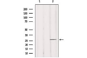 Western blot analysis of extracts from mouse brain, using BRMS1 Antibody. (BRMS1 antibody  (N-Term))