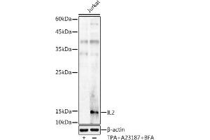 Western blot analysis of extracts of Jurkat cells, using IL2 antibody (ABIN3020908, ABIN3020909, ABIN3020910 and ABIN6213790) at 1:1000 dilution. (IL-2 antibody  (AA 21-153))