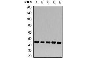 Western blot analysis of Beta-actin expression in 293T (A), Hela (B), mouse kidney (C), rat heart (D), rat brain (E) whole cell lysates. (beta Actin antibody)